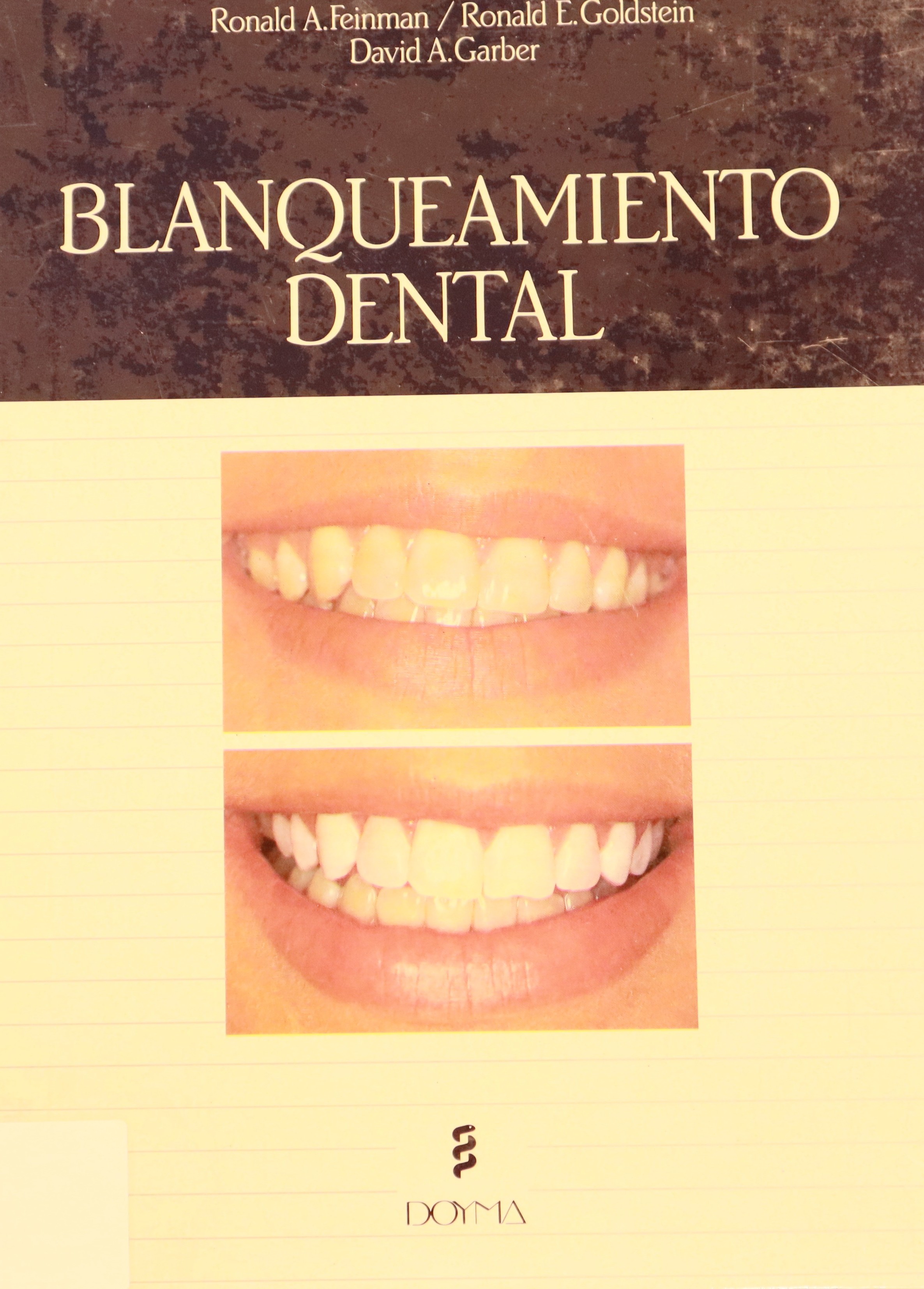 BLANQUEAMIENTO DENTAL