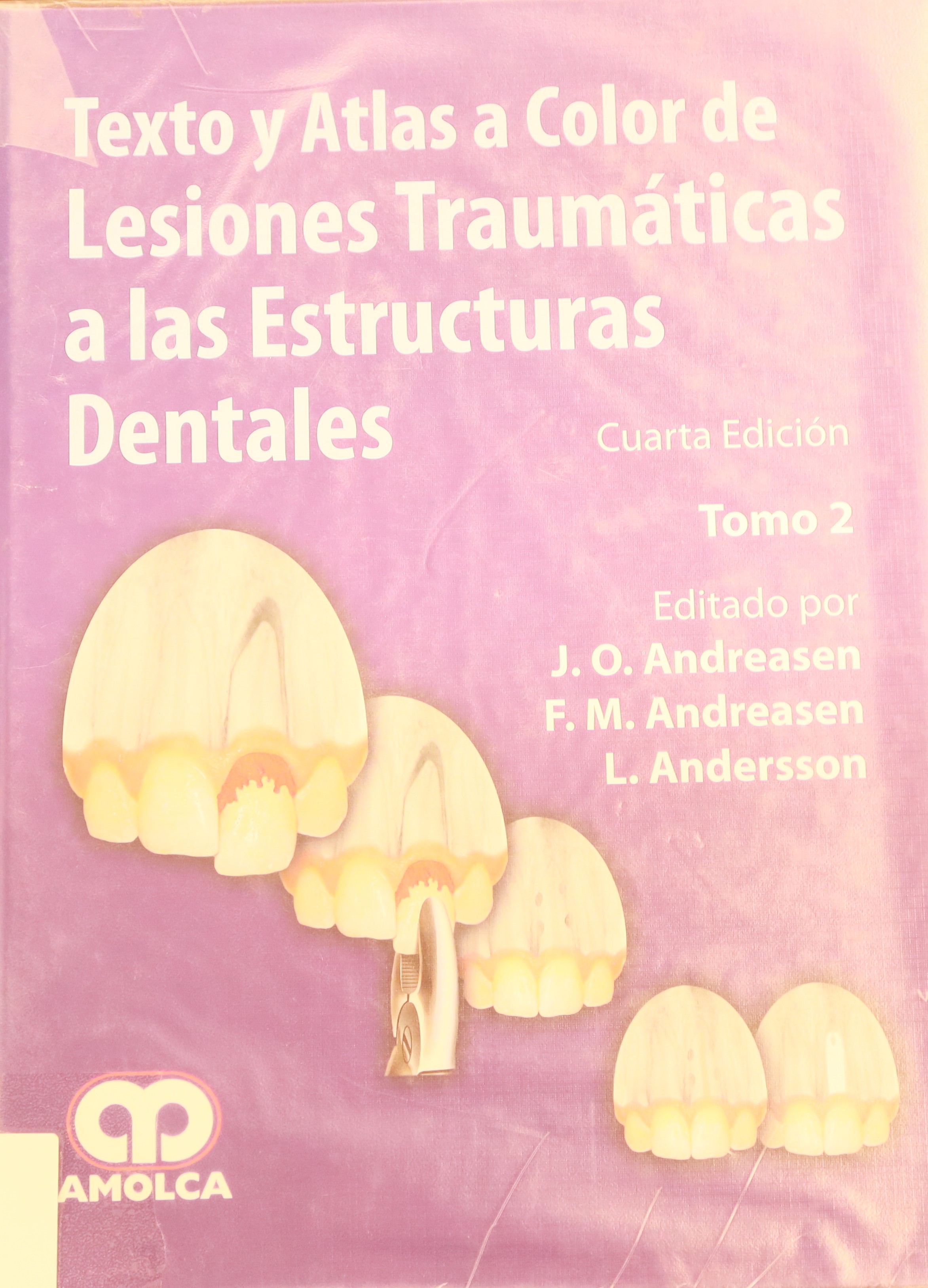 TEXTO Y ATLAS A COLOR DE LESIONES TRAUMÁTICAS A LAS ESTRUCTURAS DENTALES TOMO II