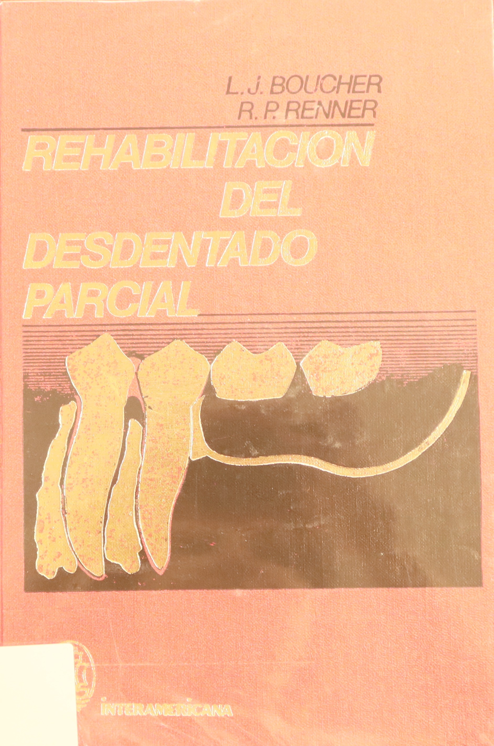 REHABILITACIÓN DEL DESDENTADO PARCIAL