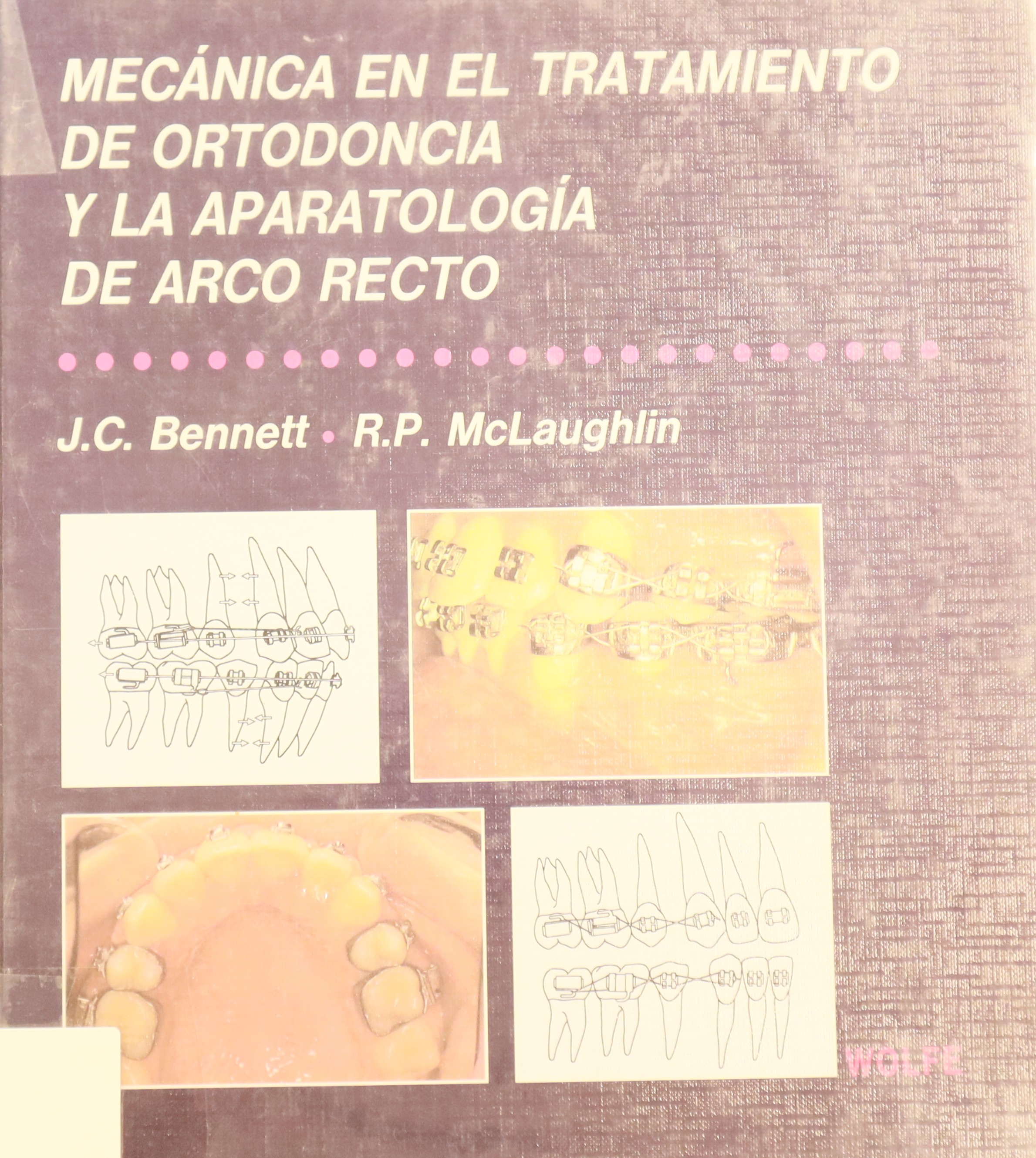 MECÁNICA EN EL TRATAMIENTO DE ORTODONCIA Y LA APARATOLOGÍA DE ARCO RECTO