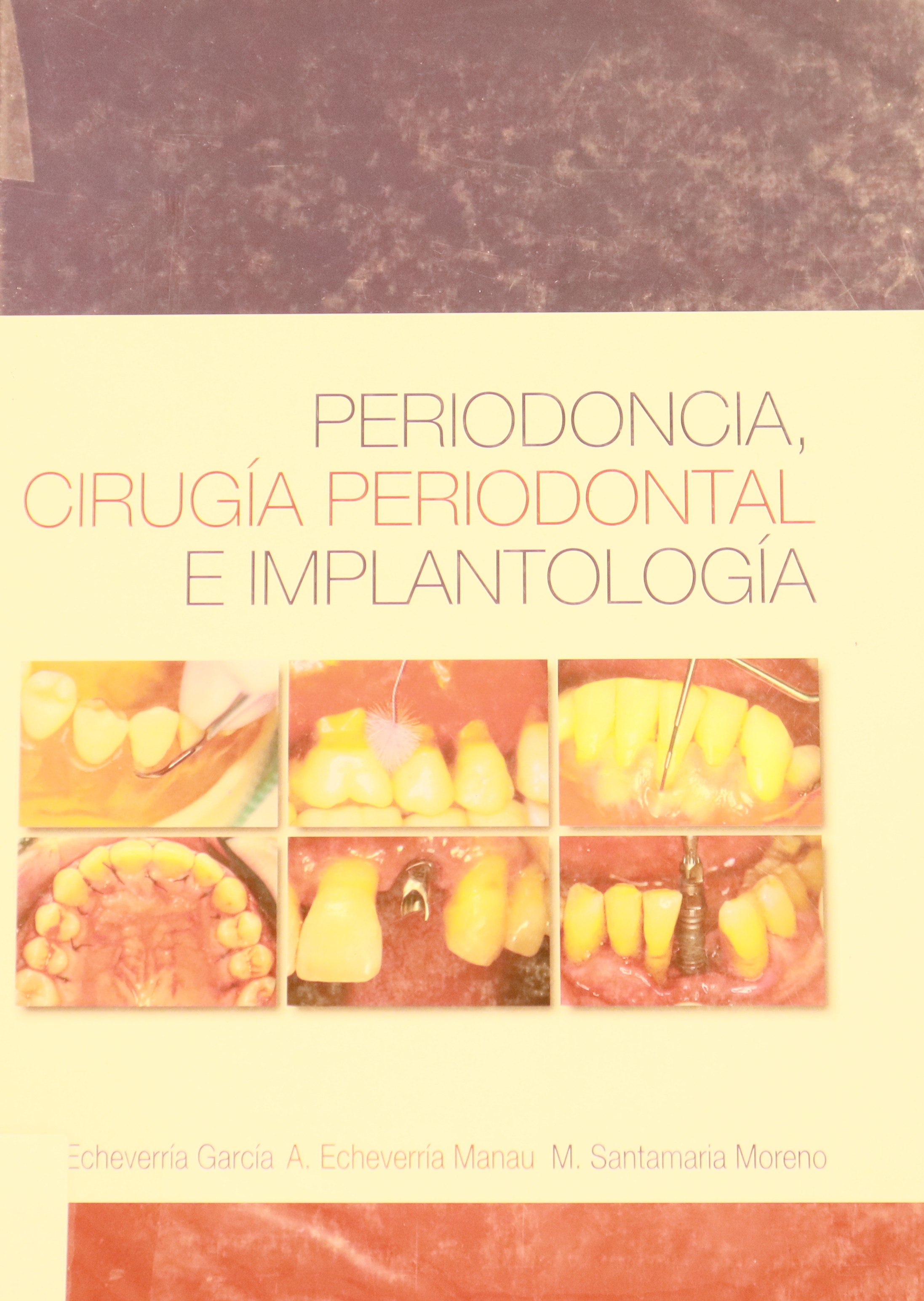 PERIODONCIA, CIRUGÍA PERIODONTAL E IMPLANTOLOGÍA