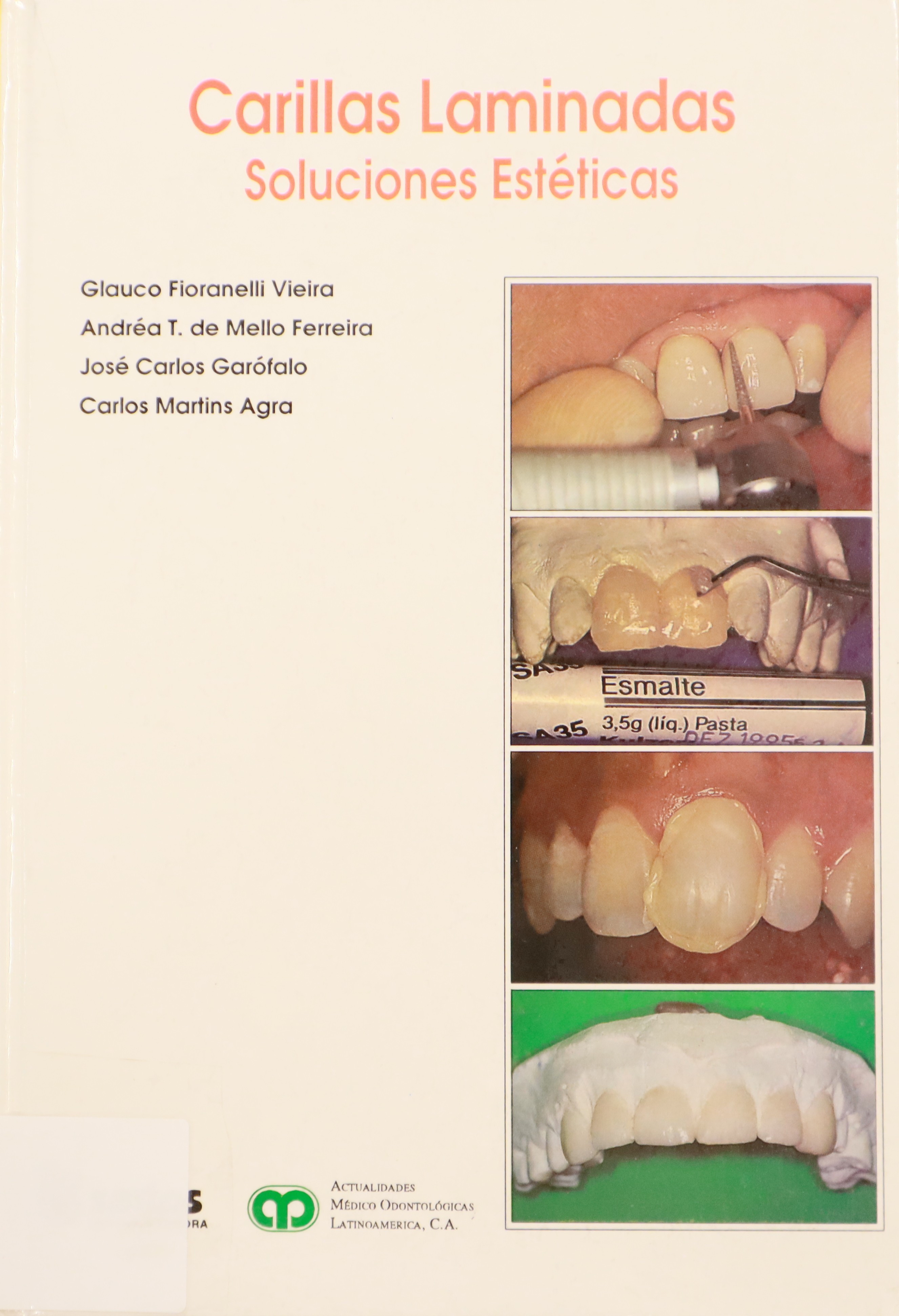 CARILLAS LAMINADAS. SOLUCIONES ESTÉTICAS.