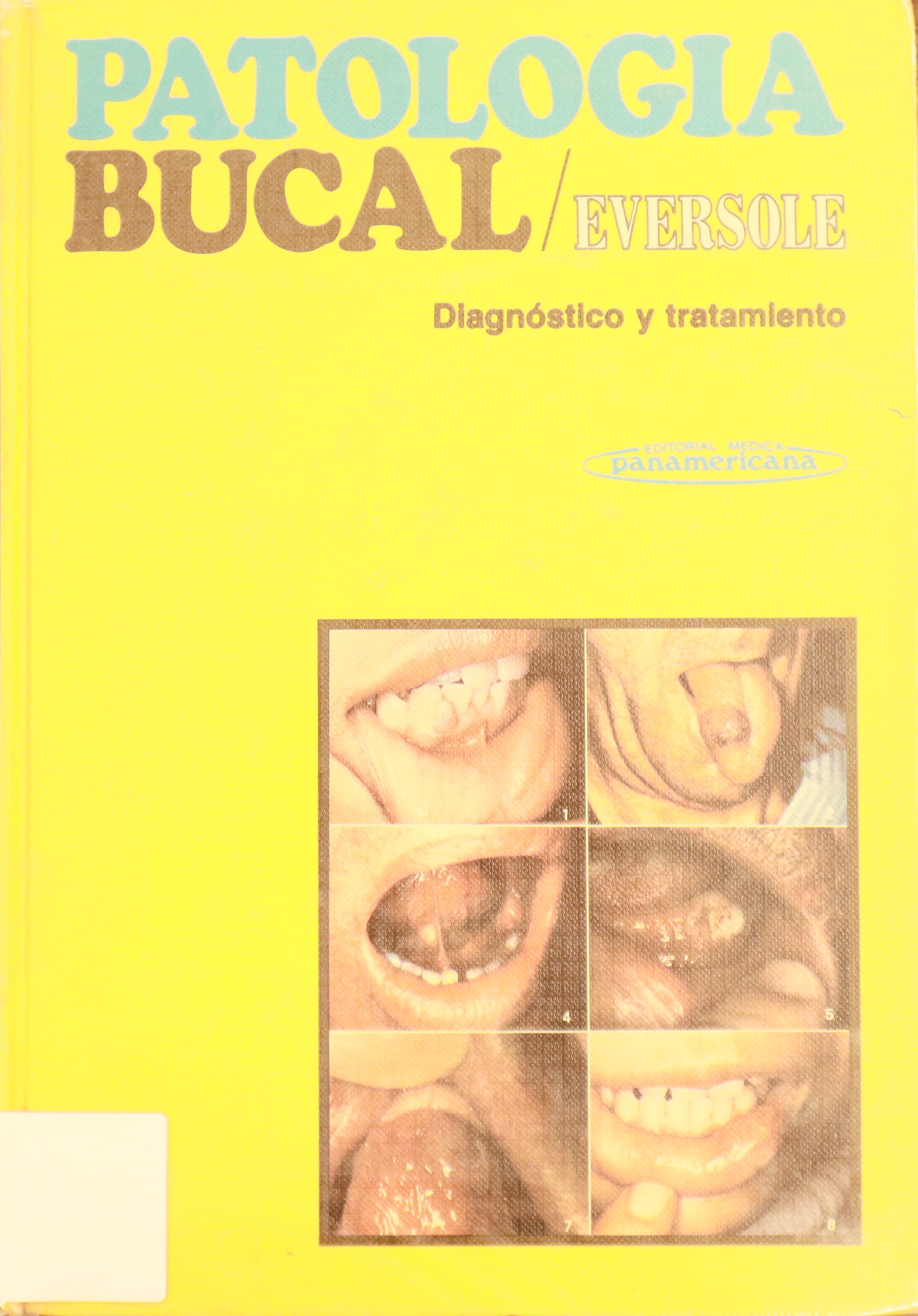 PATOLOGÍA BUCAL. DIAGNÓSTICO Y TRATAMIENTO.