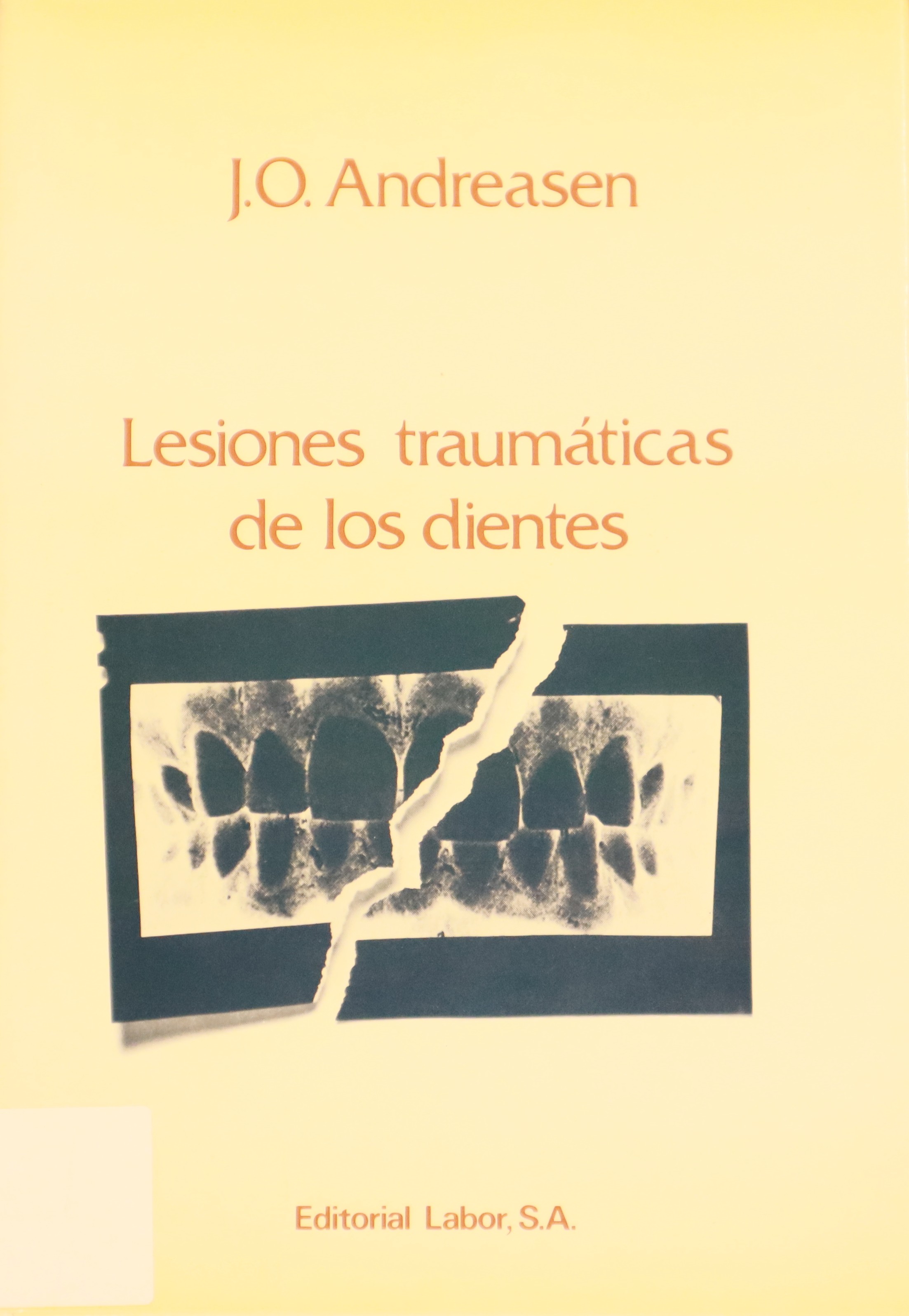 LESIONES TRAUMÁTICAS DE LOS DIENTES