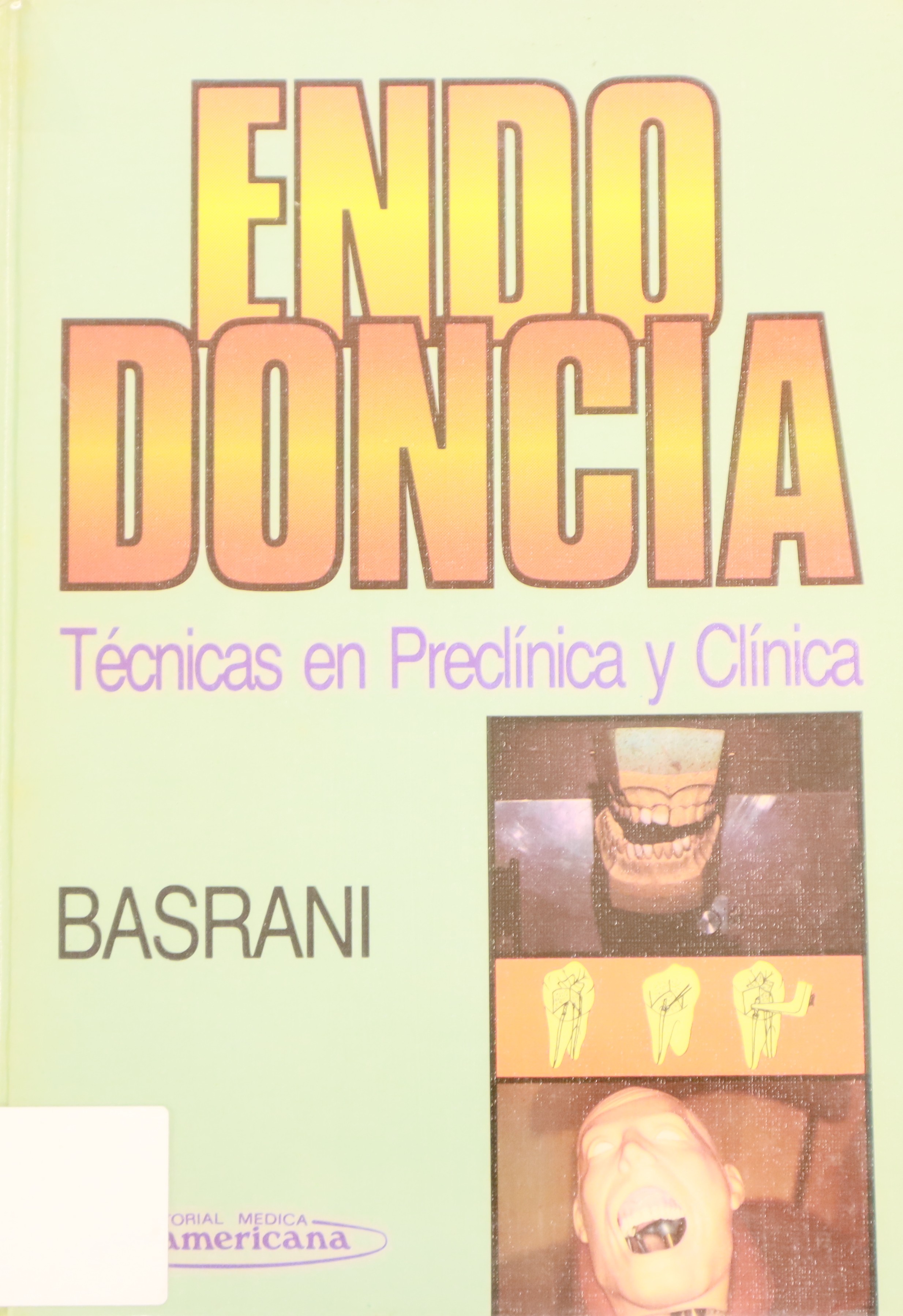 ENDODONCIA. TÉCNICA EN PRECLÍNICA Y CLÍNICA.