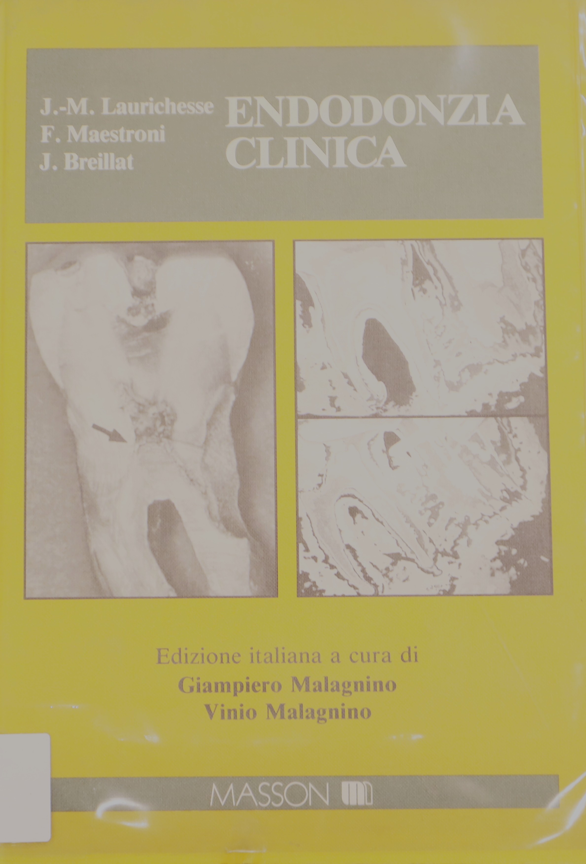 ENDODONZIA CLÍNICA