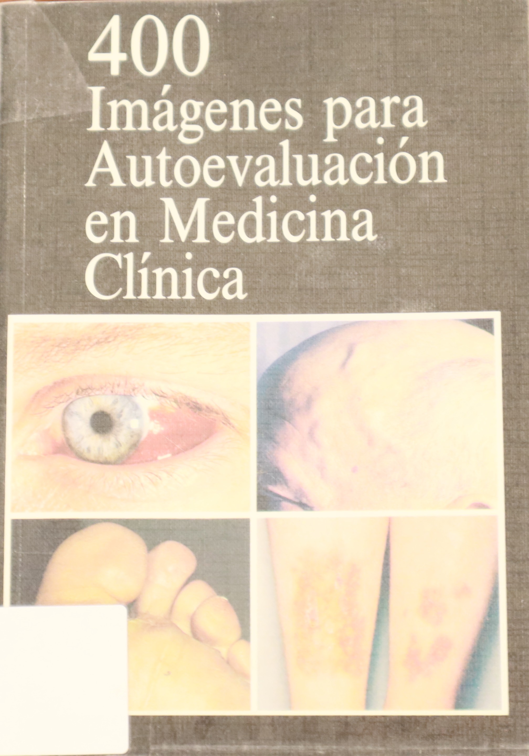 400 IMÁGENES PARA AUTOEVALUACIÓN EN MEDICINA CLÍNICA