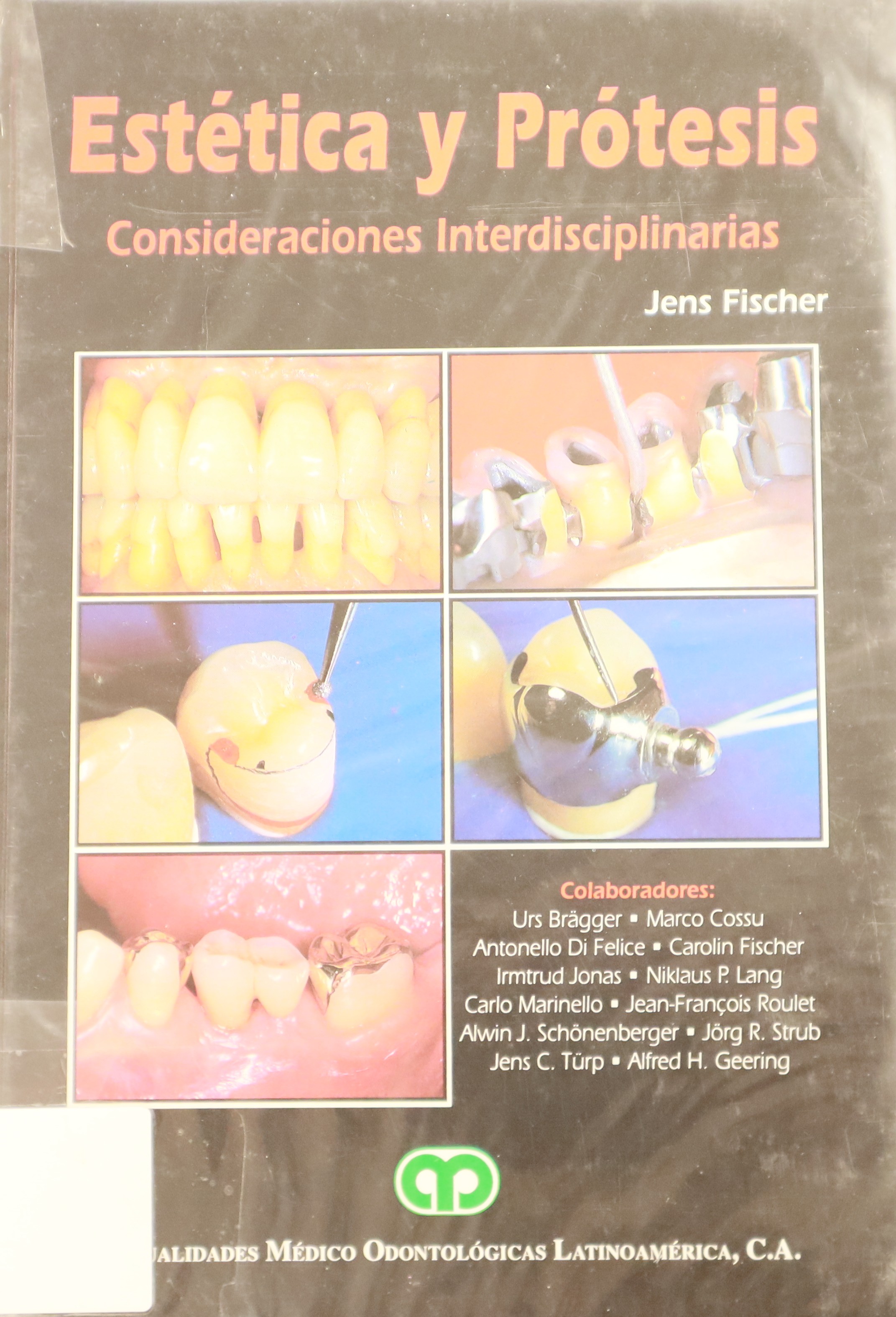 ESTÉTICA Y PRÓTESIS. CONSIDERACIONES INTERDISCIPLINARIAS.