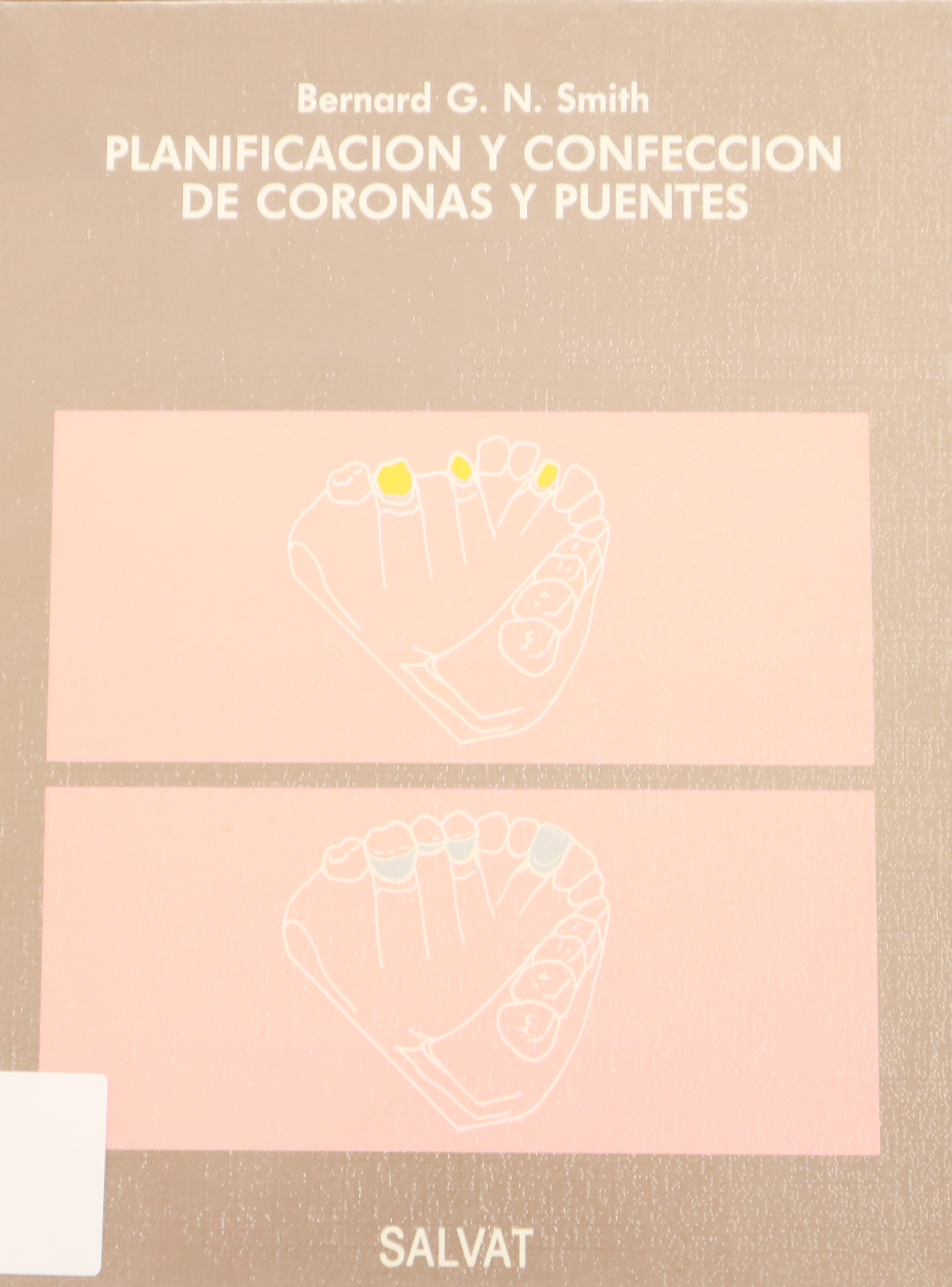 PLANIFICACIÓN Y CONFECCIÓN DE CORONAS Y PUENTES