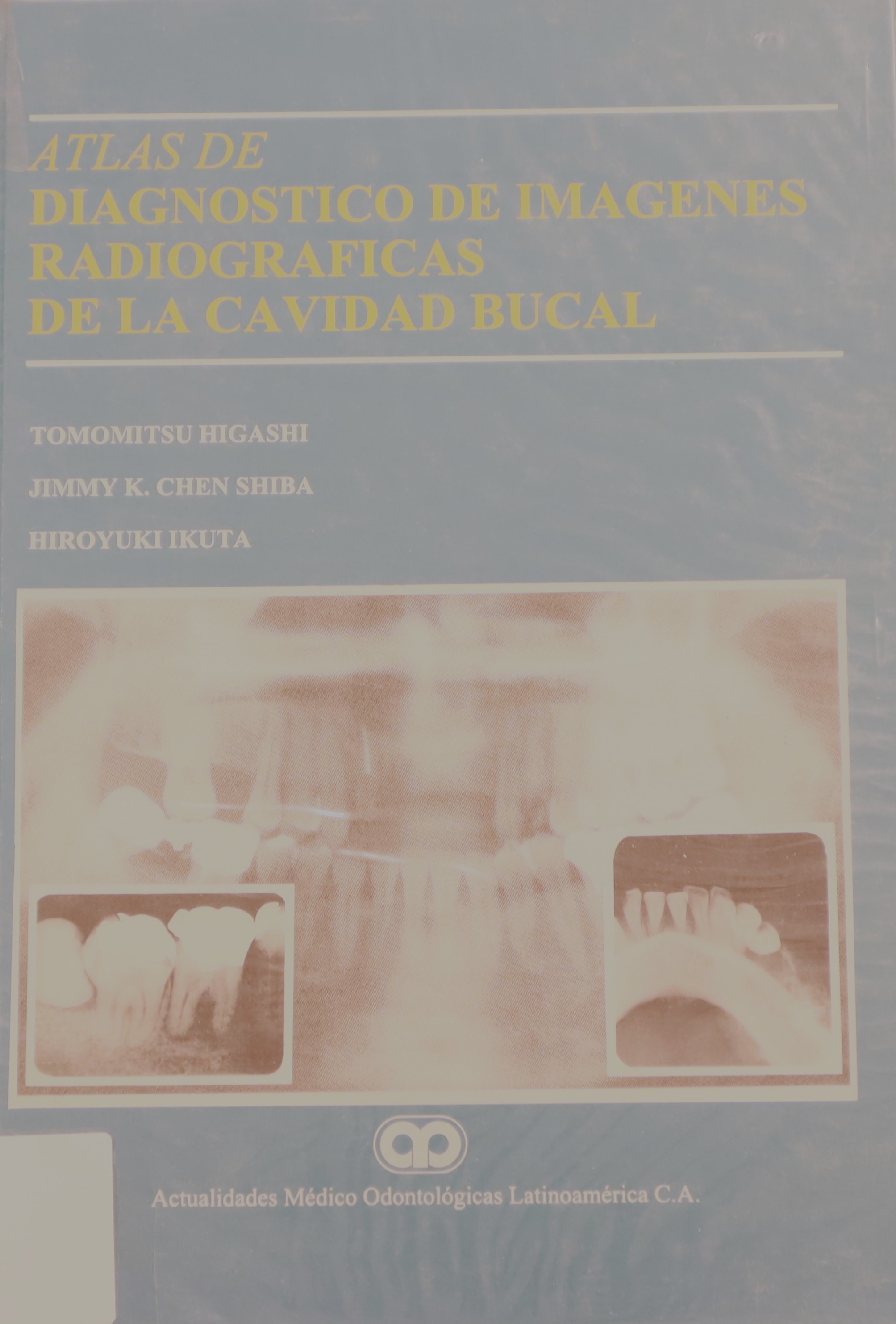 ATLAS DE DIAGNÓSTICO DE IMÁGENES RADIOGRÁFICAS DE LA CAVIDAD BUCAL