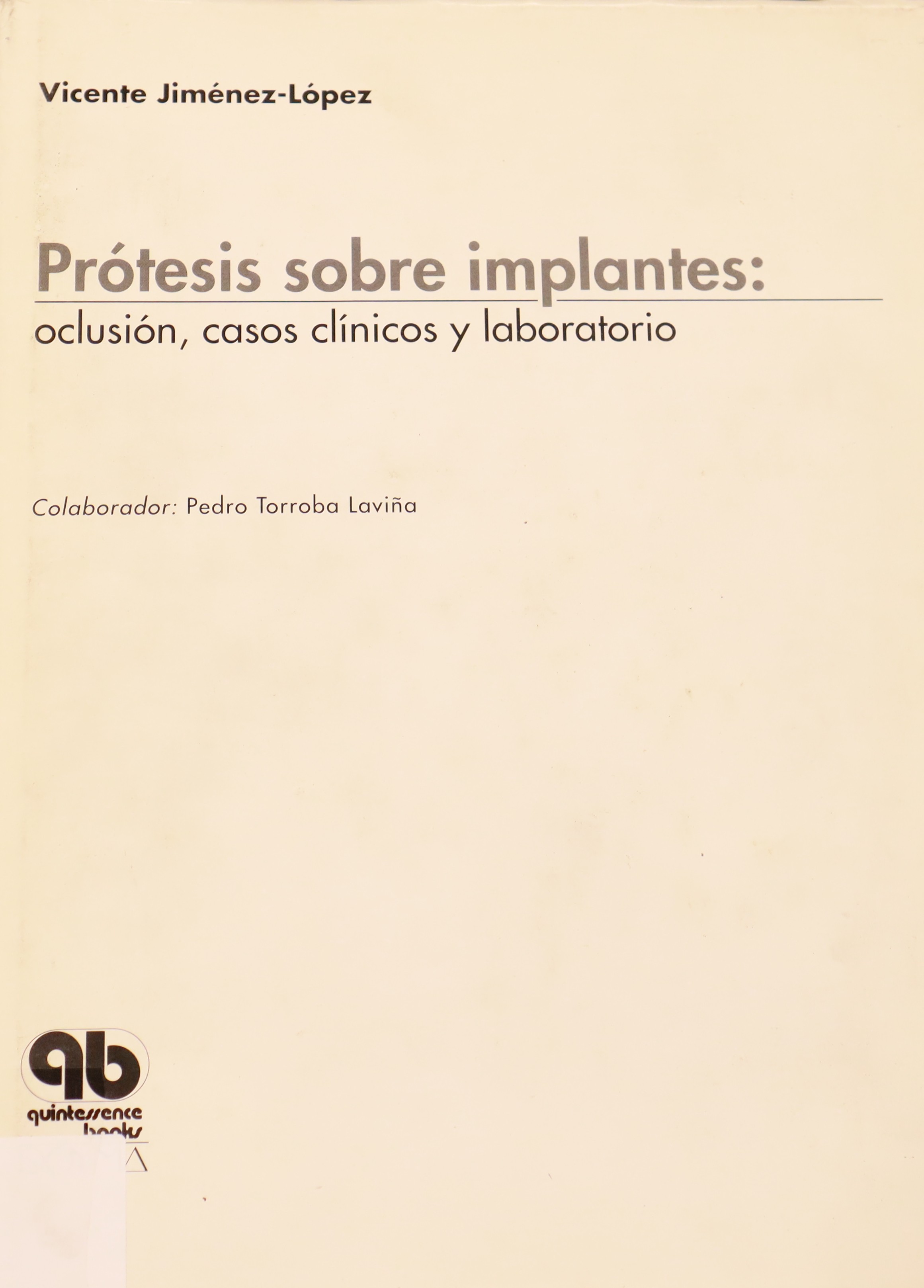 PRÓTESIS SOBRE IMPLANTES: OCLUSIÓN, CASOS CLÍNICOS Y LABORATORIO