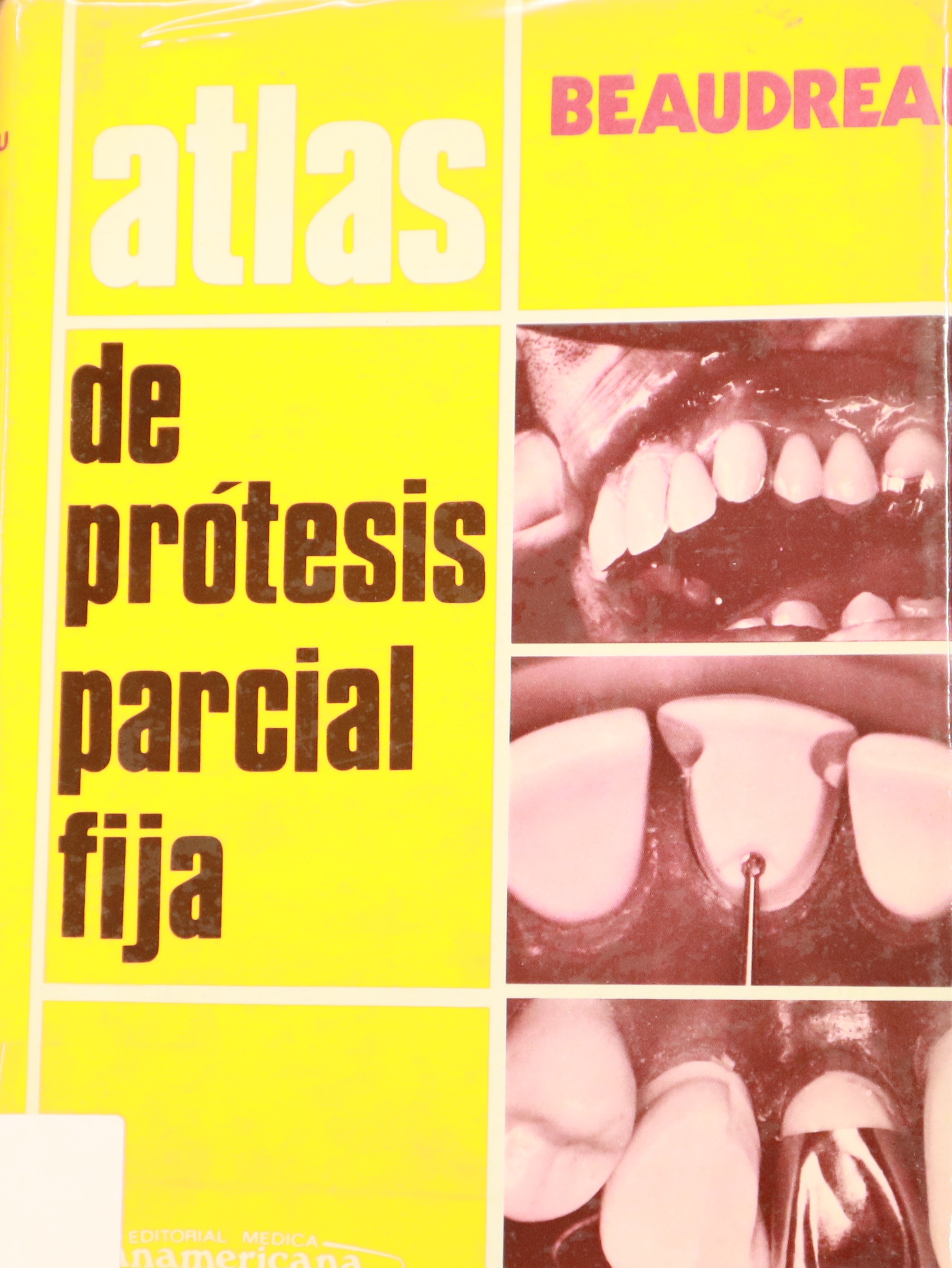 ATLAS DE PRÓTESIS PARCIAL FIJA
