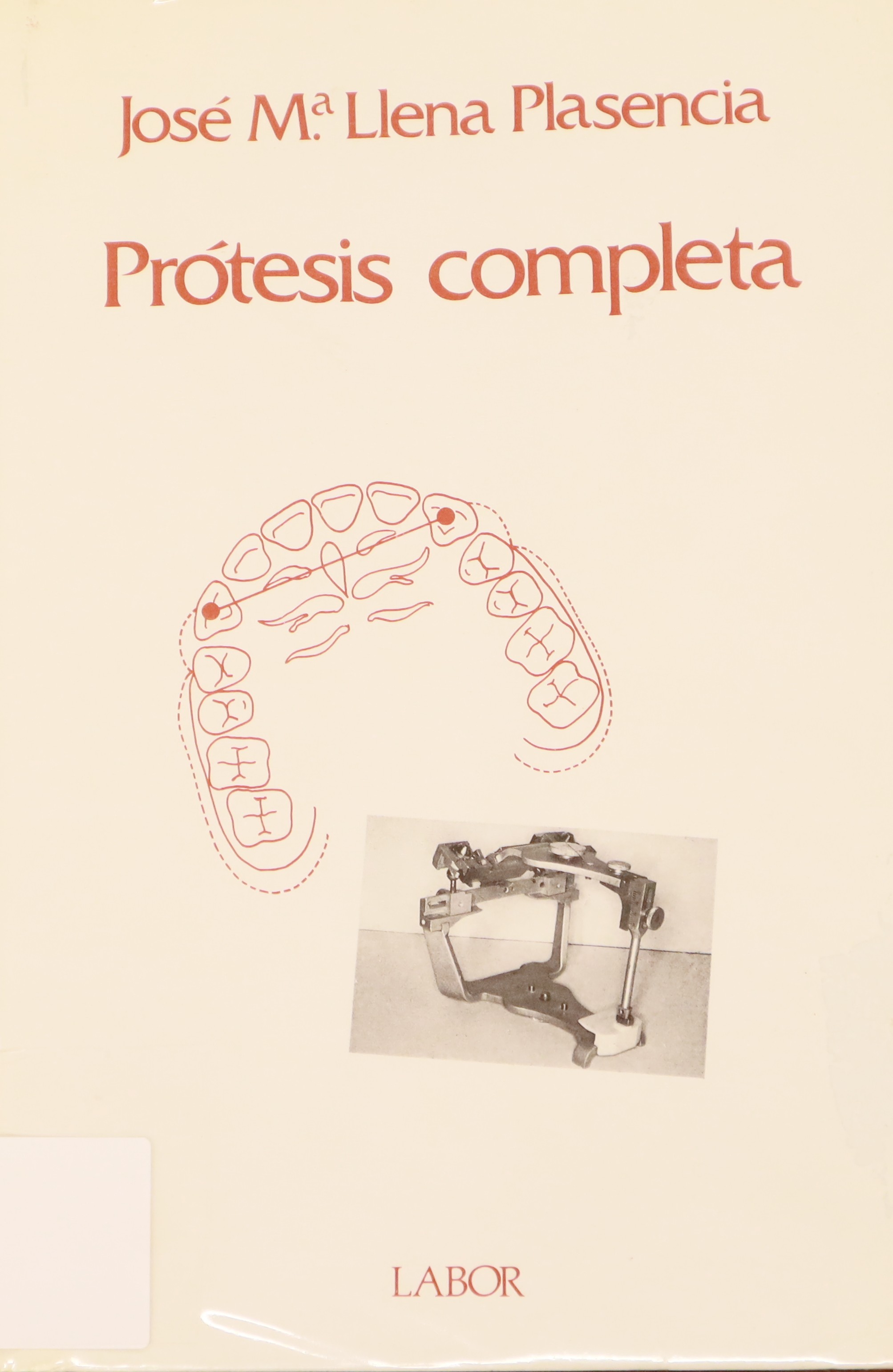 PRÓTESIS COMPLETA
