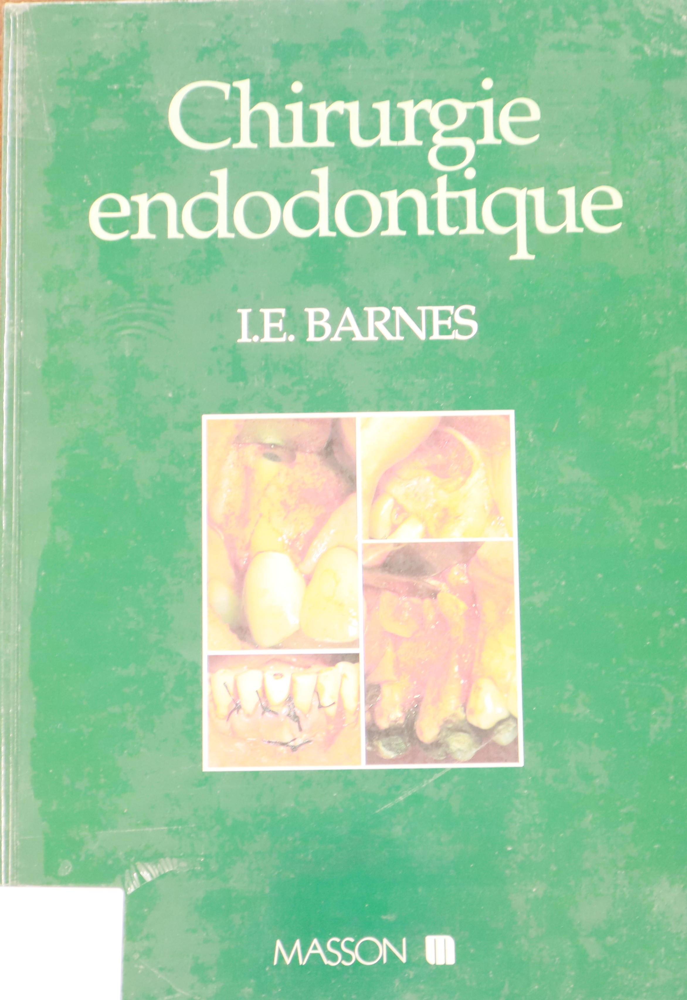CHIRURGIE ENDODONTIQUE