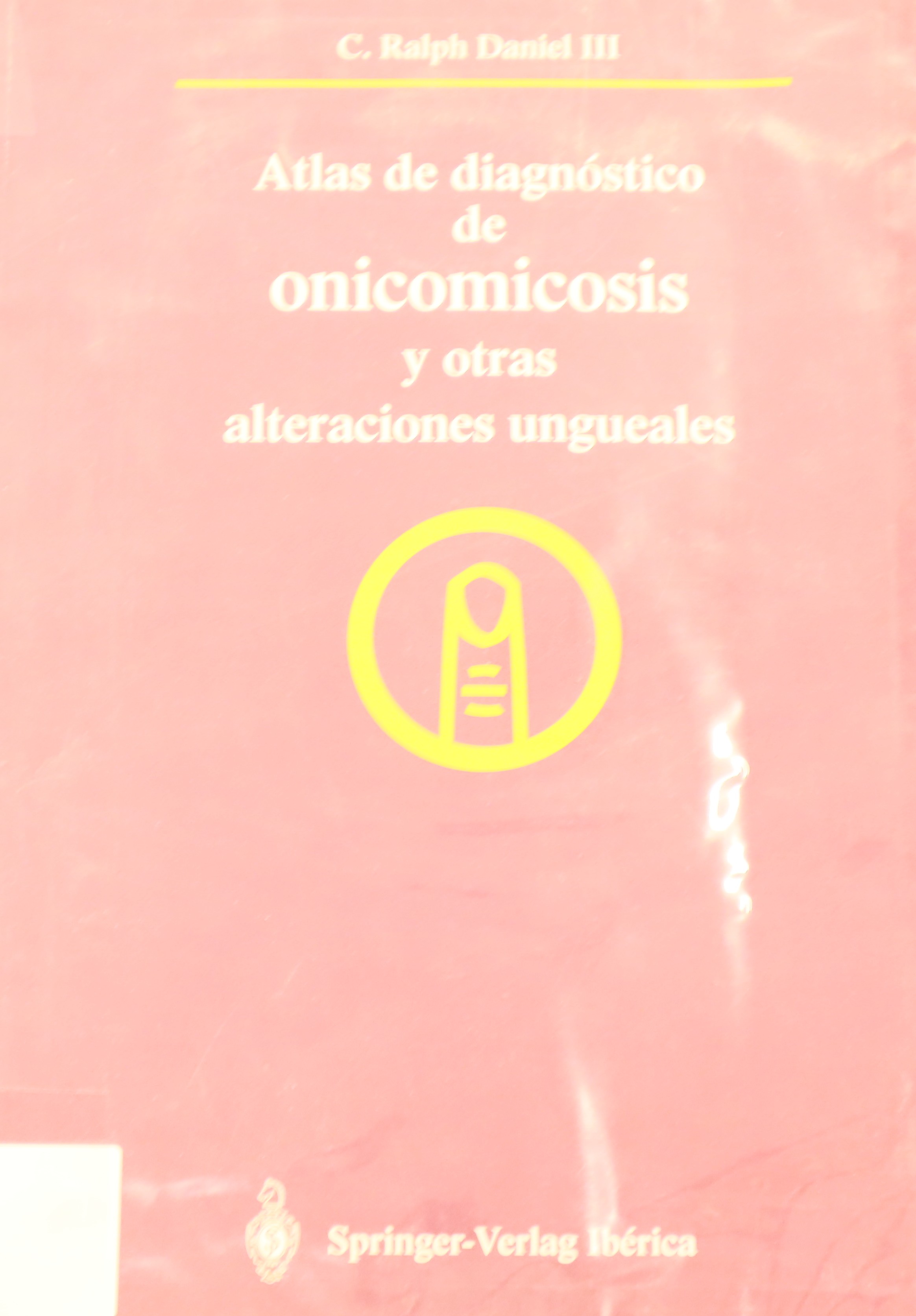 ATLAS DE DIAGNÓSTICO DE ONICOMICOSIS Y OTRAS ALTERACIONES UNGUEALES