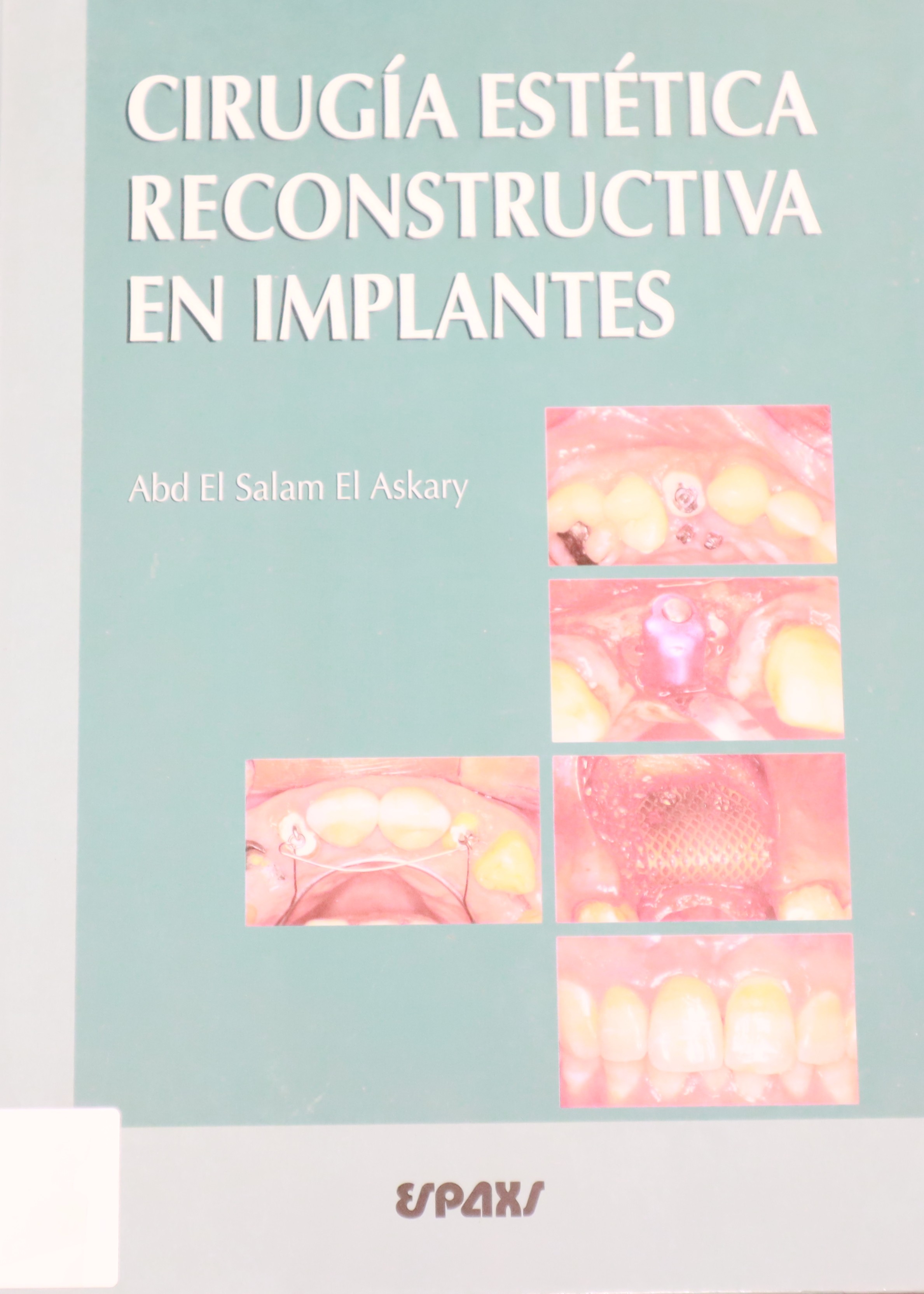 CIRUGÍA ESTÉTICA RECONSTRUCTIVA EN IMPLANTES