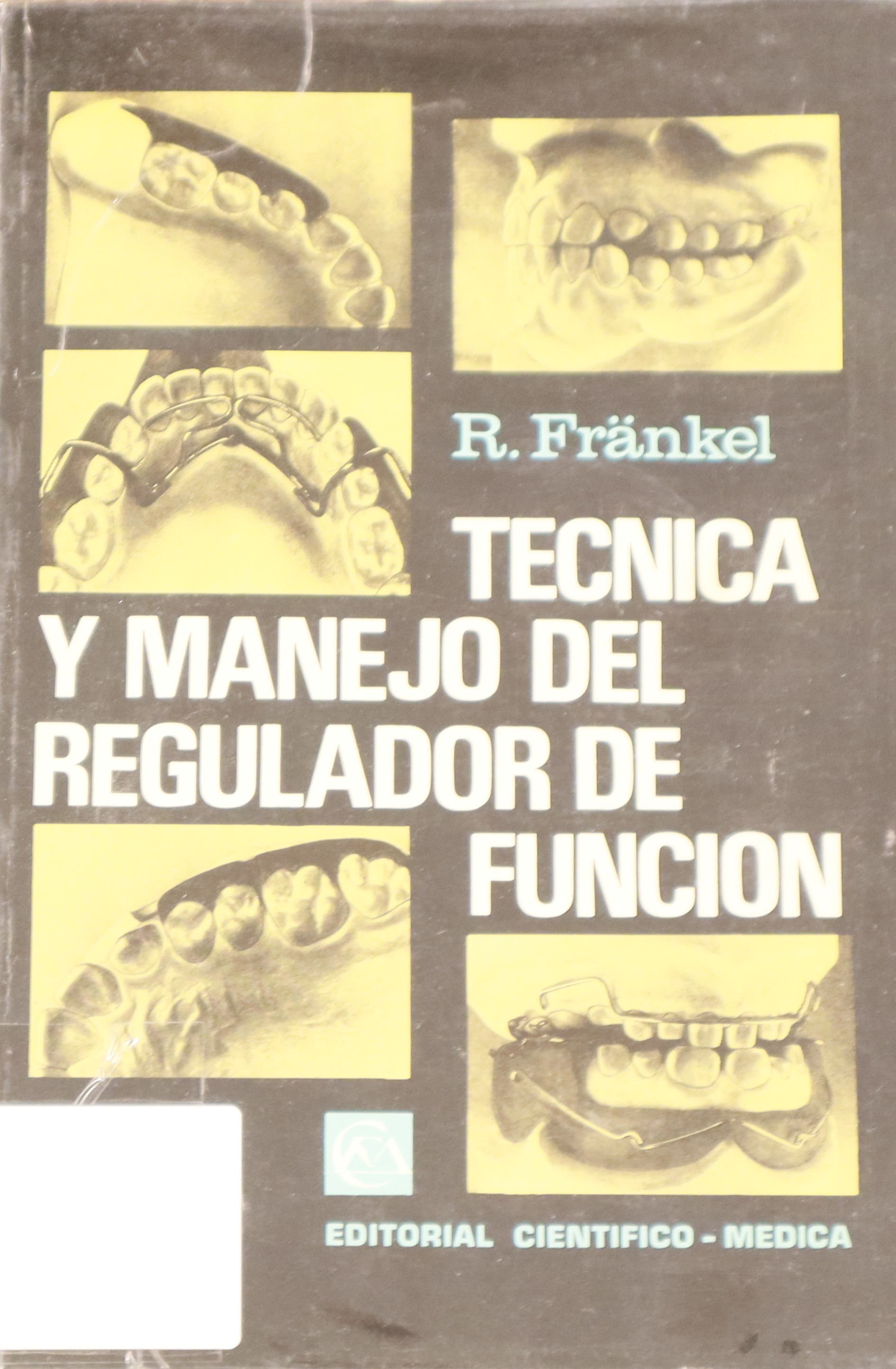 TÉCNICA Y MANEJO DEL REGULADOR DE FUNCIÓN