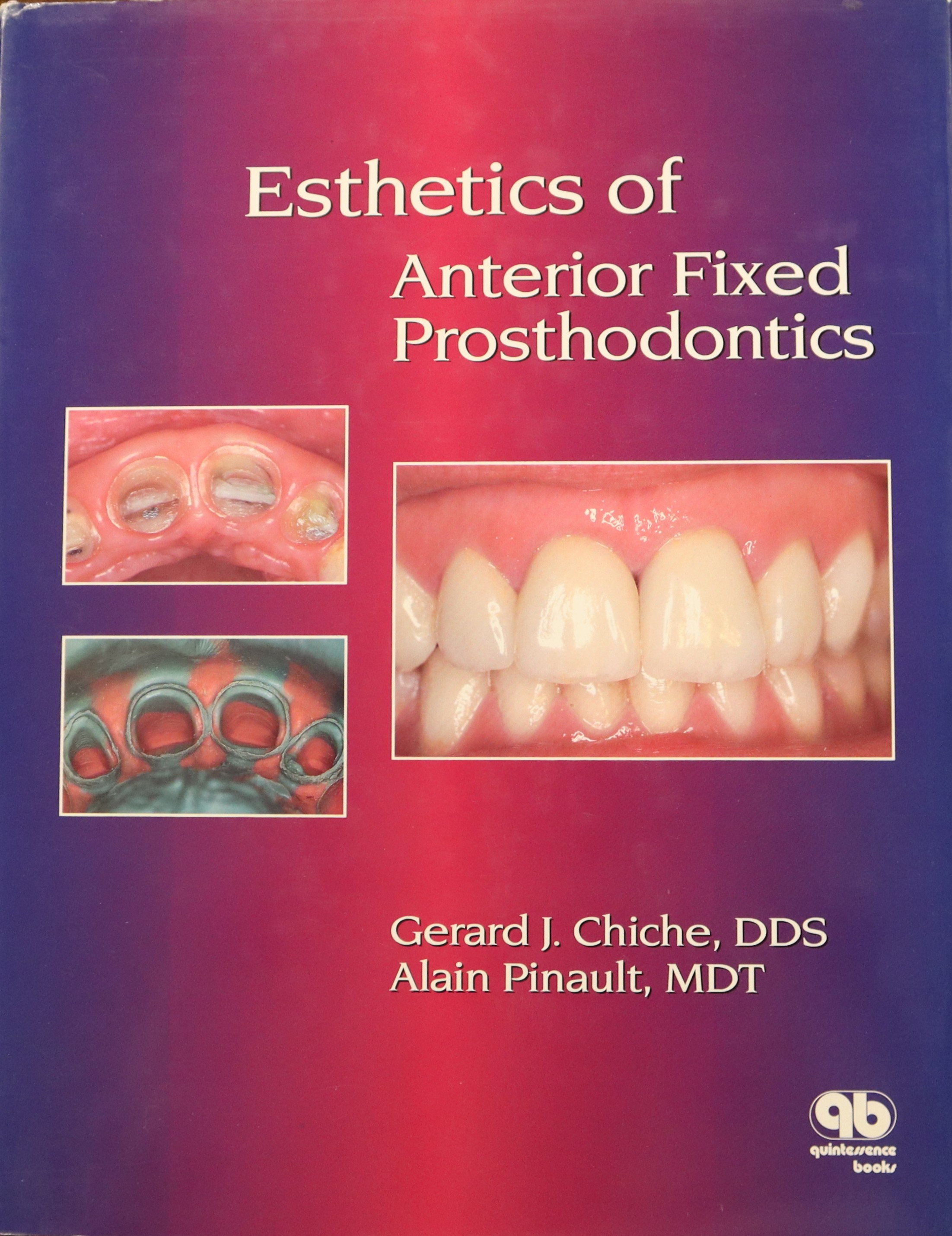 ESTHETICS OF ANTERIOR FIXED PROSTHODONTICS