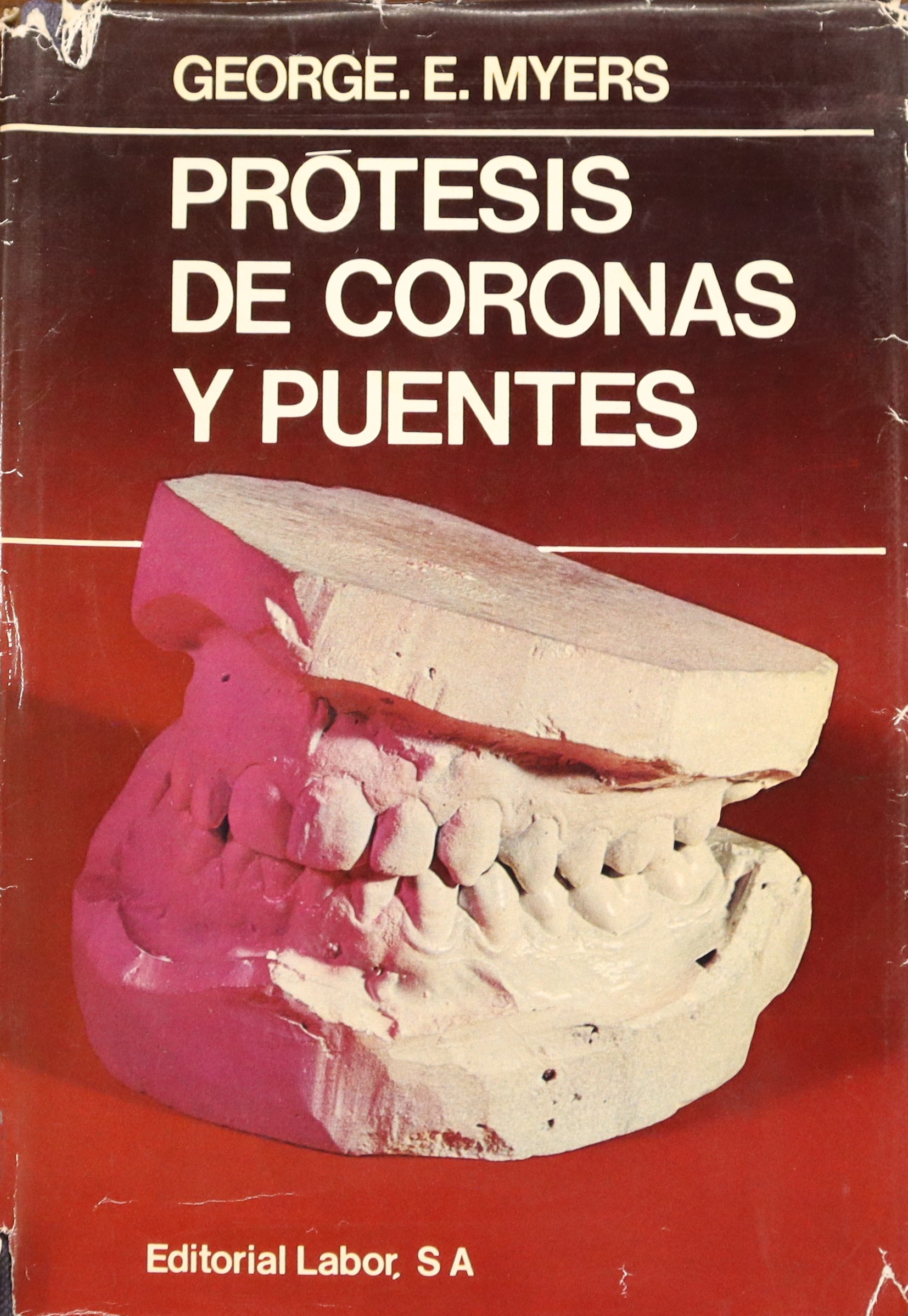 PRÓTESIS DE CORONAS Y PUENTES