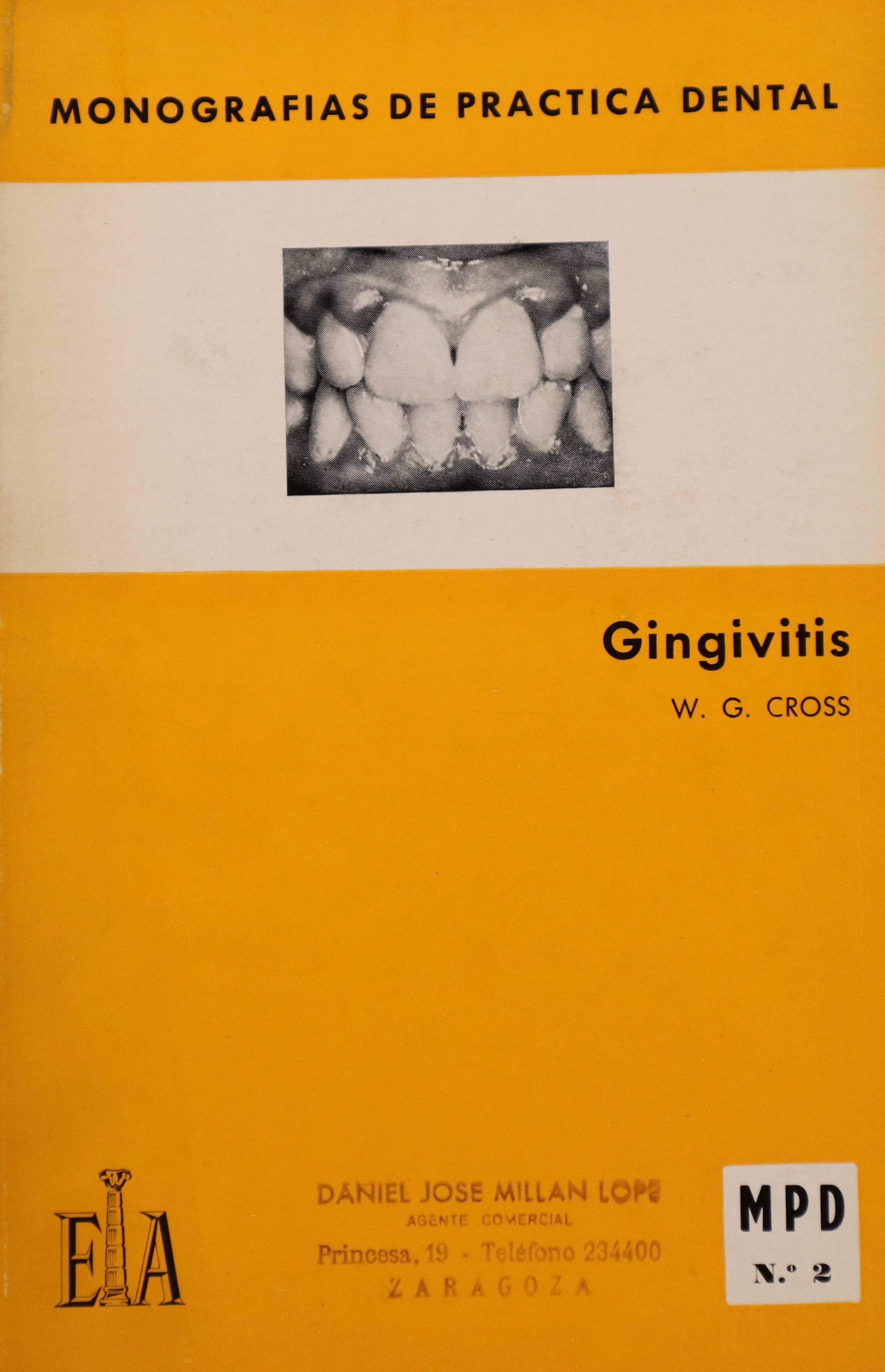 MONOGRAFÍAS DE PRÁCTICA DENTAL: GINGIVITIS