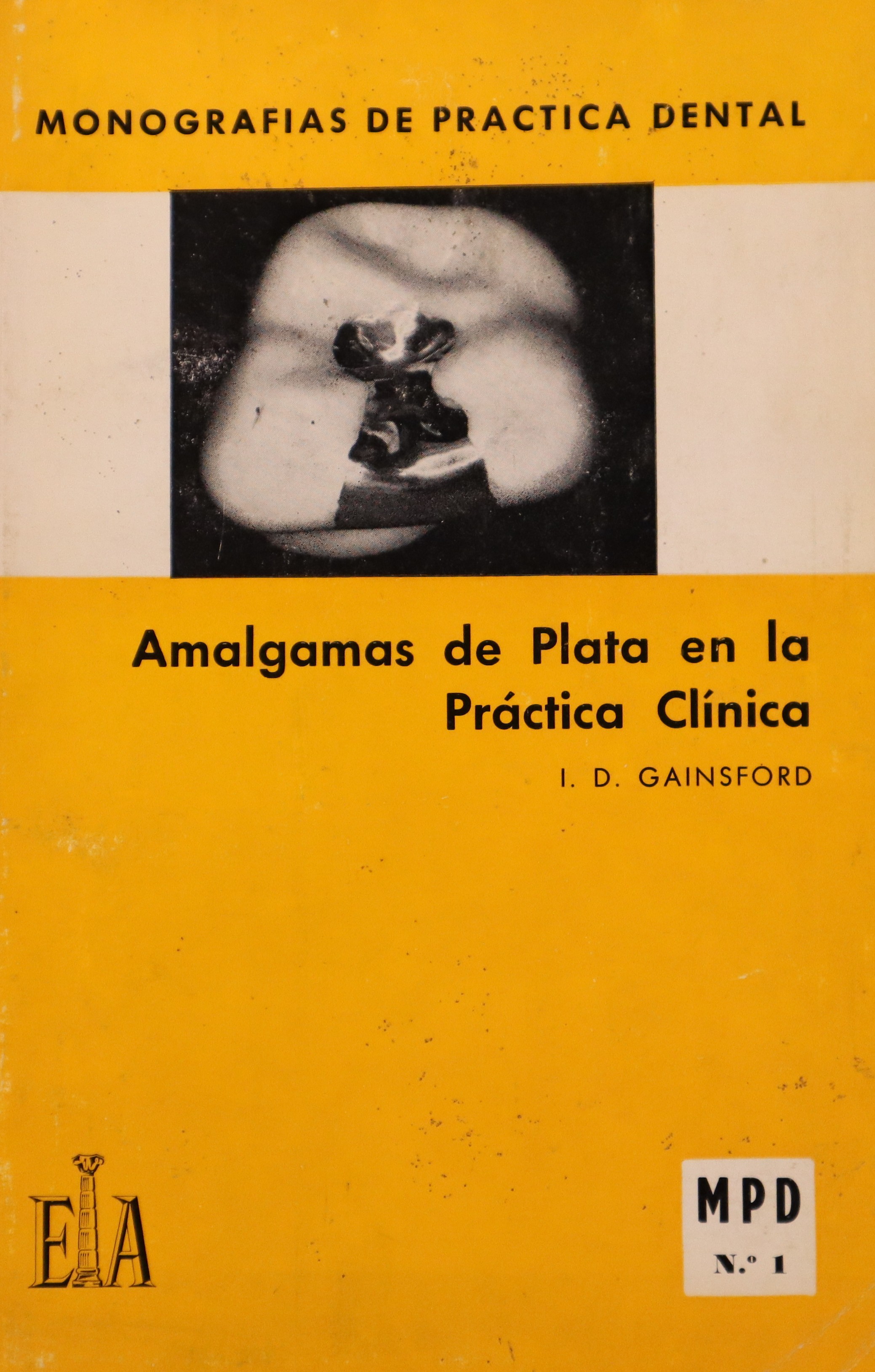 MONOGRAFÍAS DE PRÁCTICA DENTAL: AMALGAMAS DE PLATA EN LA PRÁCTICA CLÍNICA