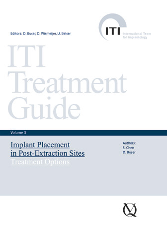 ITI TREATMENT GUIDE VOL.3. IMPLANT PLACEMENT IN POST-EXTRACTION SITES. TREATMENT OPTIONS.