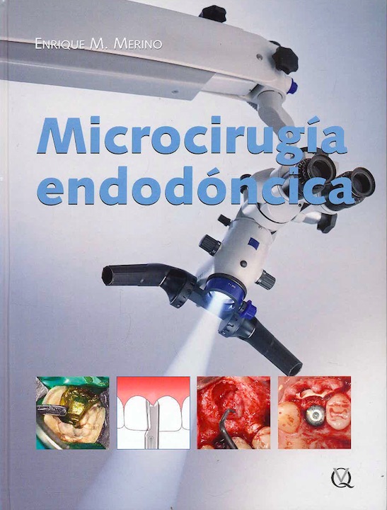 MICROCIRUGÍA ENDODÓNCICA
