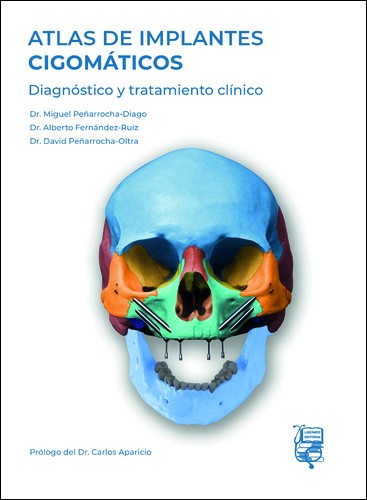ATLAS DE IMPLANTES CIGOMÁTICOS: DIAGNÓSTICO Y TRATAMIENTO CLÍNICO