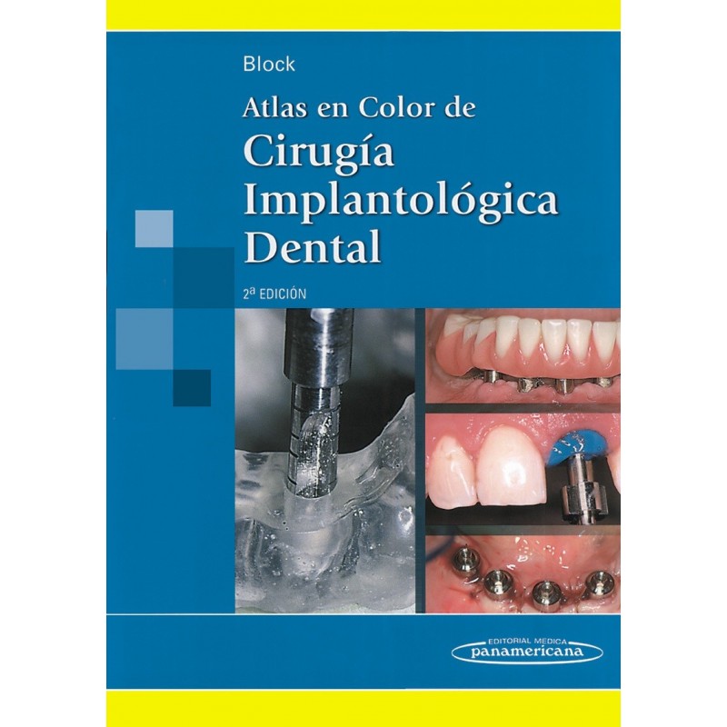 ATLAS EN COLOR DE CIRUGÍA IMPLANTOLÓGICA DENTAL 2ª EDICIÓN