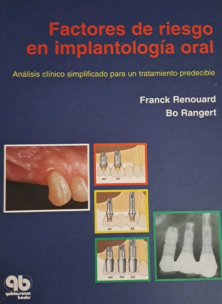 FACTORES DE RIESGO EN IMPLANTOLOGÍA ORAL