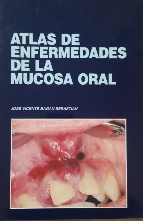 ATLAS DE ENFERMEDADES DE LA MUCOSA ORAL