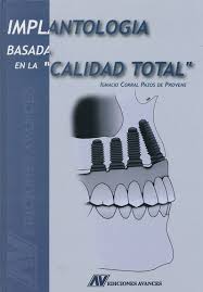 IMPLANTOLOGÍA BASADA EN LA 