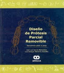 DISEÑO DE PRÓTESIS PARCIAL REMOVIBLE. SECUENCIA PASO A PASO.