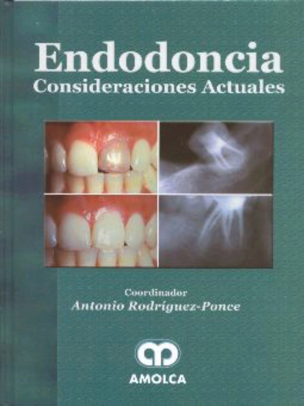 ENDODONCIA. CONSIDERACIONES ACTUALES.