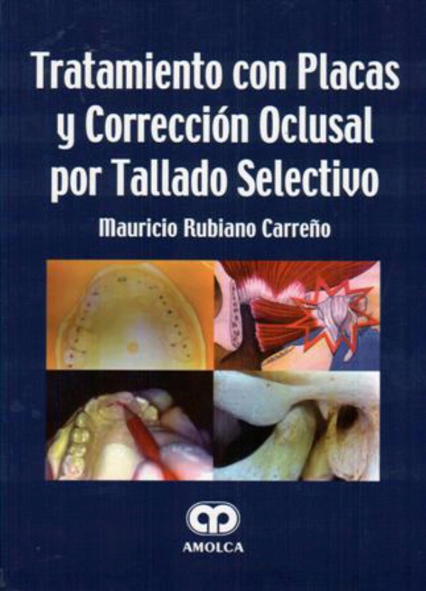 TRATAMIENTO CON PLACAS Y CORRECCIÓN OCLUSAL POR TALLADO SELECTIVO