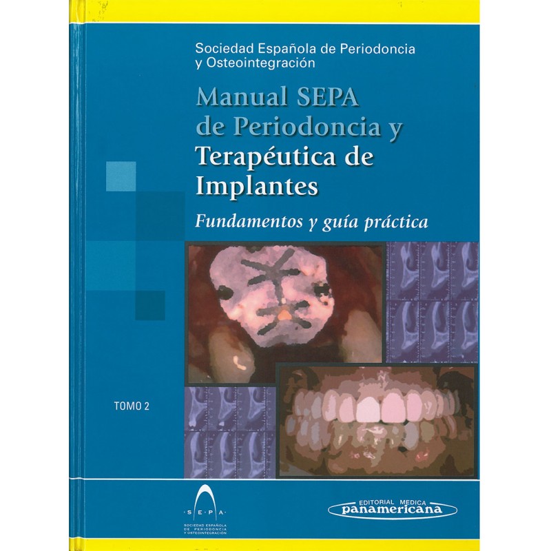 MANUAL SEPA DE PERIODONCIA Y TERAPÉUTICA DE IMPLANTES: FUNDAMENTOS Y GUÍA PRÁCTICA TOMO 2