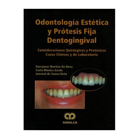 ODONTOLOGÍA ESTÉTICA Y PRÓTESIS FIJA DENTOGINGIVAL. CONSIDERACIONES QUIRÚRGICAS Y PROTÉSICAS. CASOS CLÍNICOS Y DE LABORATORIO.