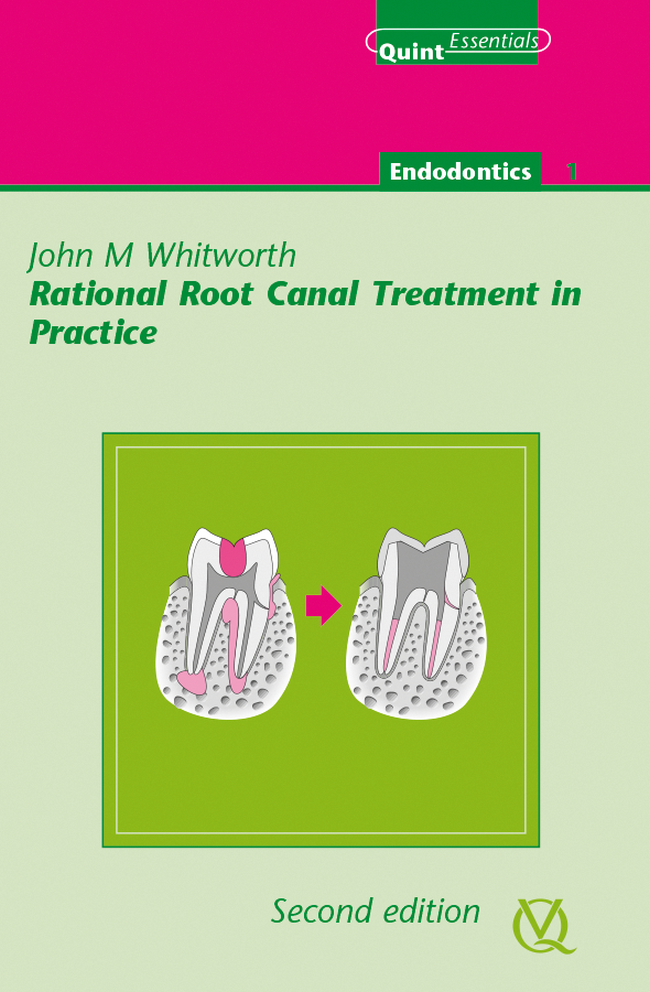 RATIONAL ROOT CANAL TREATMENT IN PRACTICE