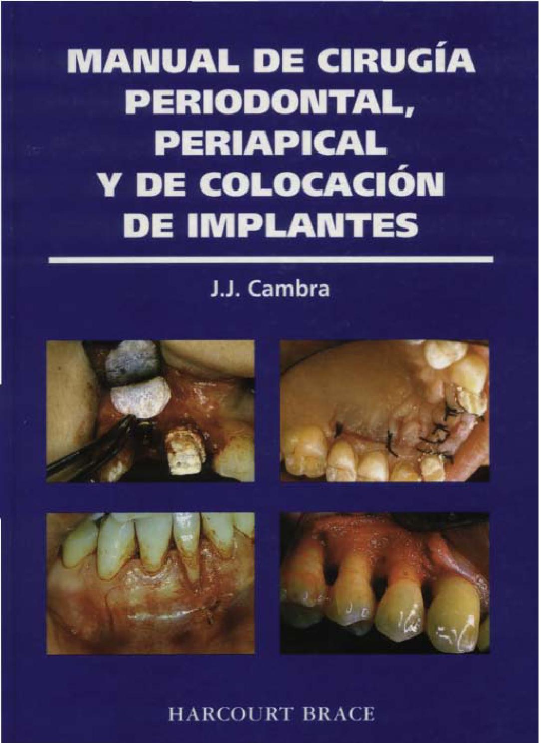 MANUAL DE CIRUGÍA PERIODONTAL, PERIAPICAL Y DE COLOCACIÓN DE IMPLANTES