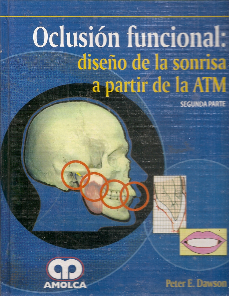 OCLUSIÓN FUNCIONAL: DISEÑO DE LA SONRISA A PARTIR DE LA ATM 2º PARTE