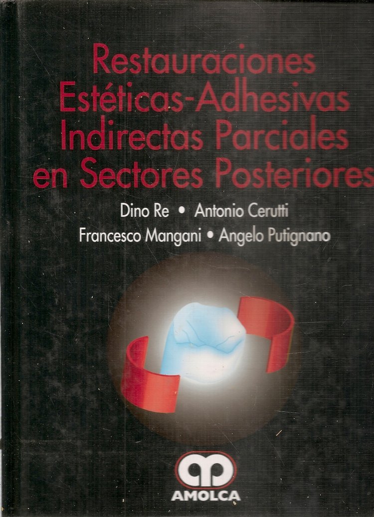 RESTAURACIONES ESTÉTICAS-ADHESIVAS INDIRECTAS PARCIALES EN SECTORES POSTERIORES