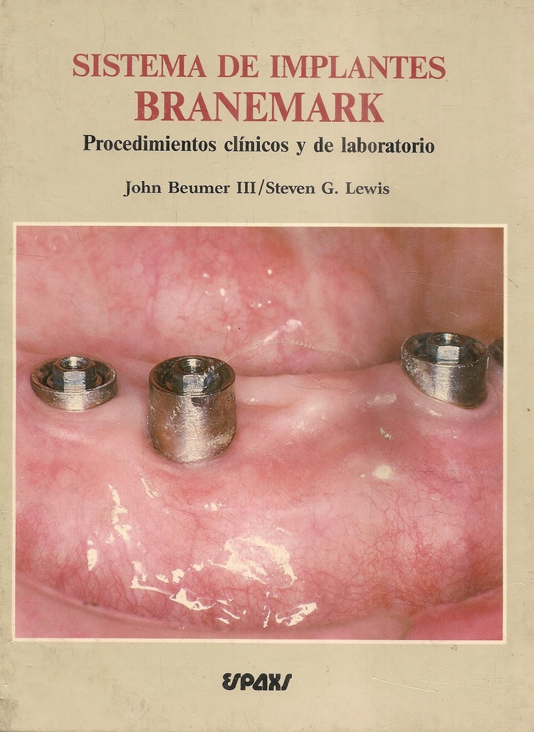 SISTEMA DE IMPLANTES BRANEMARK PROCEDIMIENTO CLÍNICOS Y DE LABORATORIO