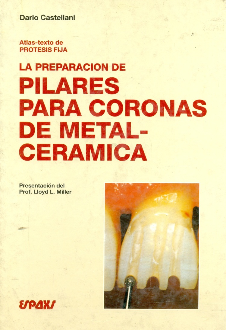 ATLAS-TEXTO DE PRÓTESIS FIJA. LA PREPARACIÓN DE PILARES PARA CORONAS DE METAL-CERÁMICA