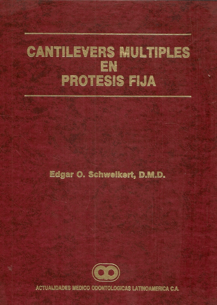 CANTILEVERS MÚLTIPLES EN PRÓTESIS FIJA