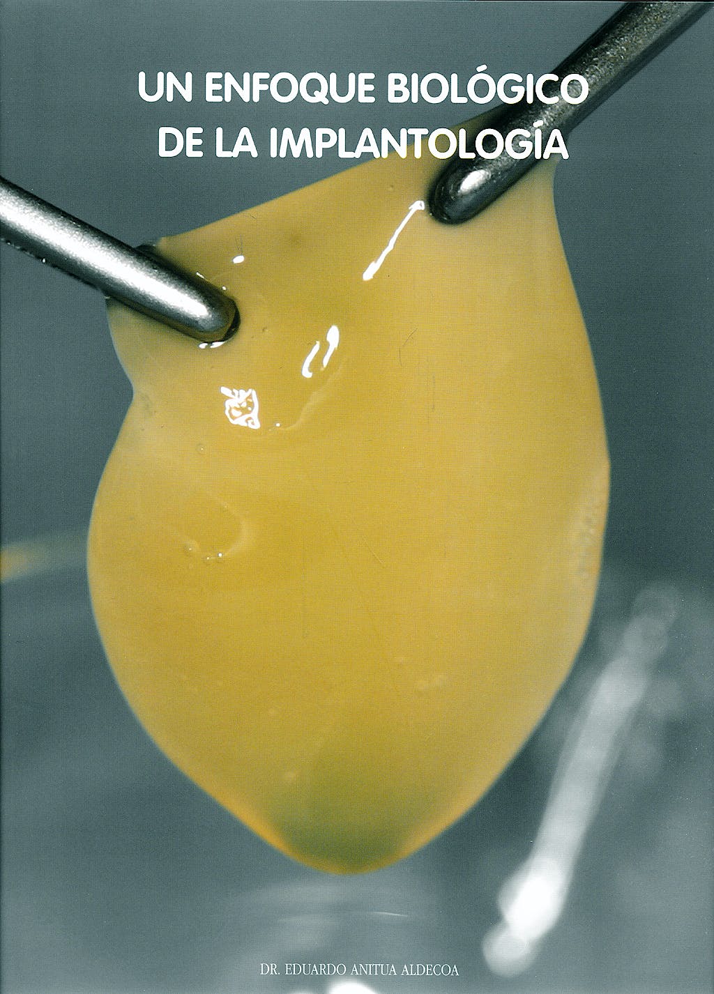 UN ENFOQUE BIOLÓGICO DE LA IMPLANTOLOGÍA